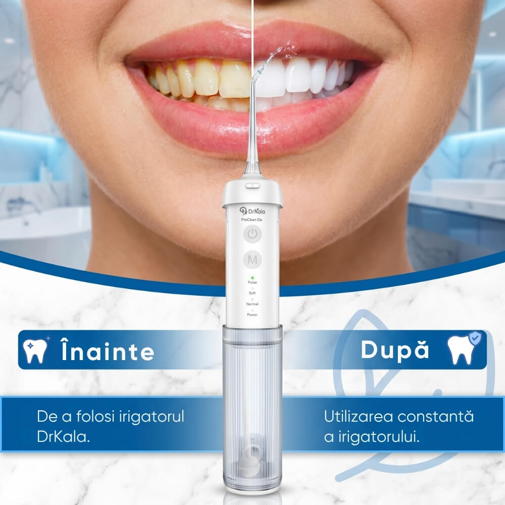 Irigator Bucal Profesional tip Dus Bucal Portabil DrKala® ProClean Go, pliabil, 4 moduri de curatare, pana la 1999 pulsatii/min, rezervor 210 ml, baterie 1500 mAh, 4 capete incluse, Rezistent la apa IPX7, incarcare USB-C, Alb